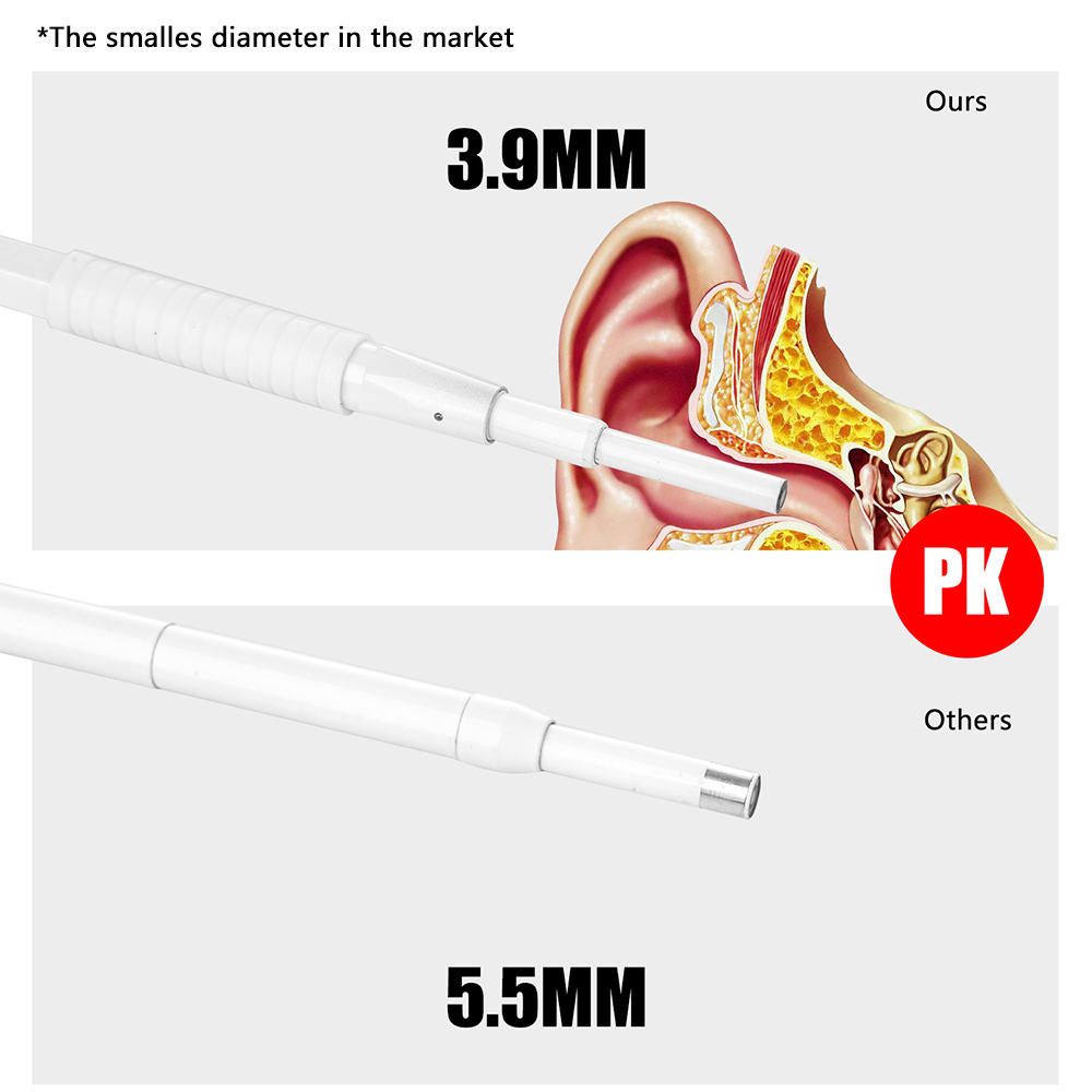 USB Digital Otoscope